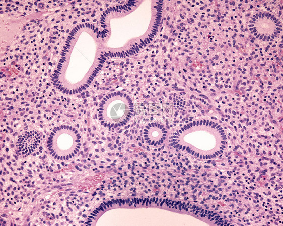 人类子宫内膜增殖期几个管状子宫内膜腺体被横切显示其简单的柱状上皮其中图片