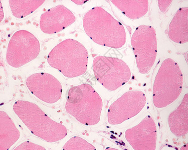横截面中的骨骼横纹肌纤维显示位于细胞外围的几个细胞核图片