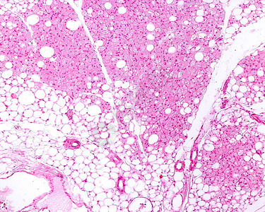 而棕色脂肪细胞显示出海绵状的外观图片
