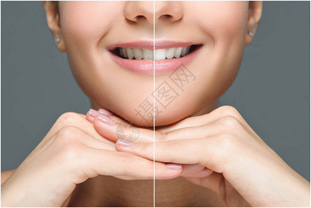 在牙前和牙齿后微笑着女人的部分面孔白地图片