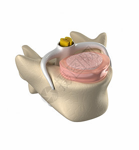 正常椎间盘脊髓和核图片