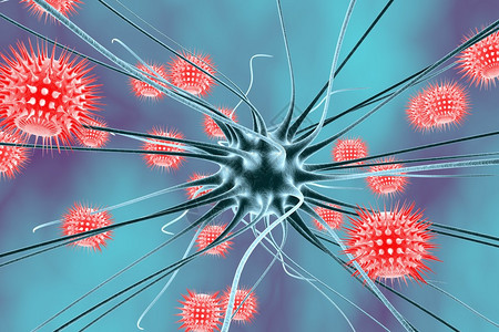脑炎神经感染脑部感染神经元和感染的脑细胞科学背景医学背景图片