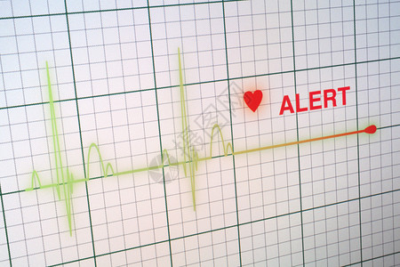 心脏监护仪上的平线警报图片