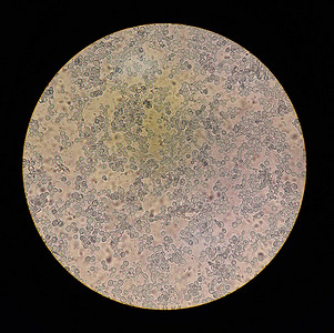 天然制剂中白色念珠菌的显微镜观察图片素材