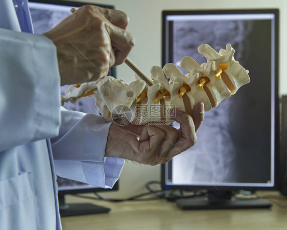 神经外科医生用铅笔指着医务室的腰椎型结巴神经根图片