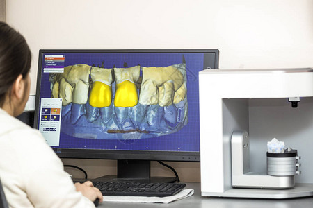 在计算机上使用牙科软件平台制作假牙的人使用专软件的图片
