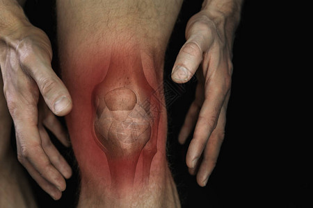 膝盖疼痛男腿骨关节炎症插图图片