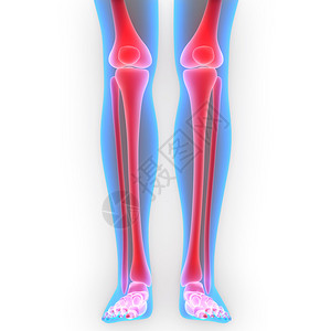 3D人体骨联合疼痛Leg图片