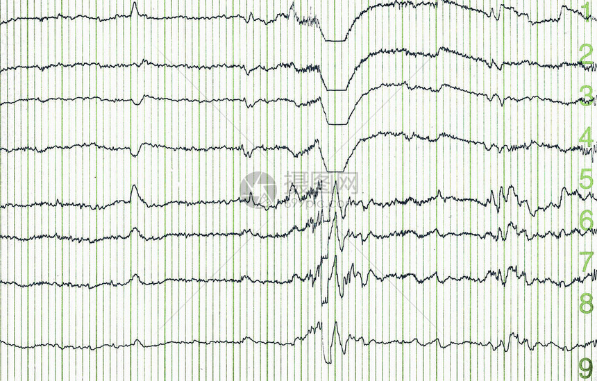 EEG 503619304 eeg-503619304