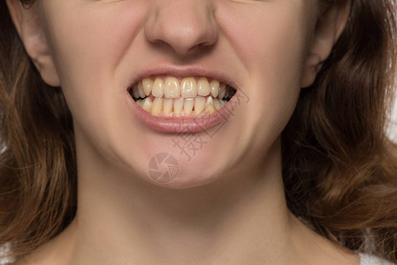 黄的牙不均匀和弯曲一个年图片