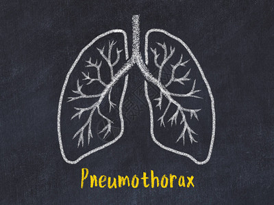 学习医学的概念用粉笔画肺上面写着气胸图片