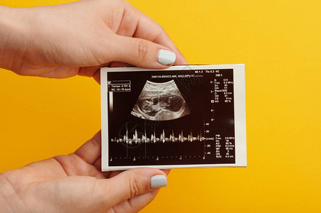 怀孕检查时对健康婴儿进图片