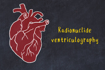 将人的心切粉笔画在黑纸板和刻录的放射核素脑电图片