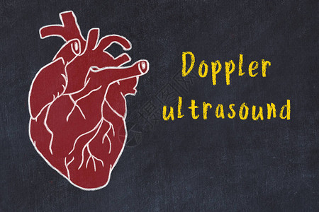 在黑纸板和刻着多普勒超声波的刻字上图片