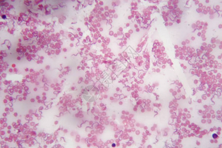 人类血液的显微镜照片与造成非洲锥虫病或昏睡病的寄生虫TrypanosomaBr图片