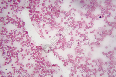人类血液的显微镜照片与造成非洲锥虫病或昏睡病的寄生虫TrypanosomaBr图片