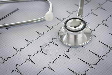 心脏病患者心电图表上的听诊器心脏病专背景图片