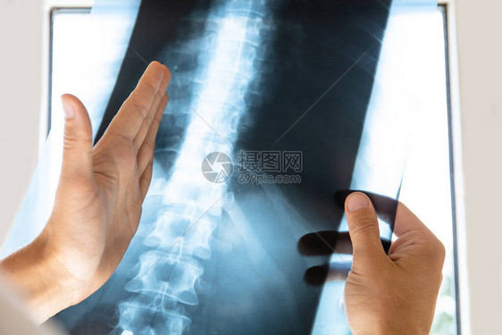 医生检查人体脊柱的X射线照片图片