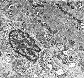 电子显微镜下的细胞核和风琴5背景图片