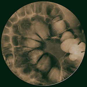 X射线Bonibor肠胃内脏检查图片
