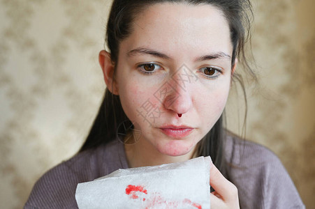 严重流鼻血的白种女人的画像患有严重疾背景图片