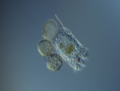 显微镜下的轮虫在水中游泳背景图片