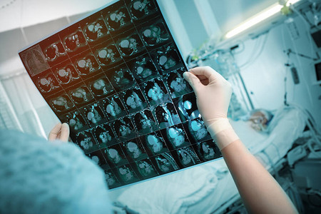 女医生在急诊室躺在床上的病人的背景下仔细检查CT扫描结果图片
