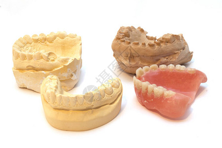 用于种植牙模型的牙科石膏印模图片