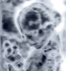 医疗设备超声波扫描妊娠诊断单位图片