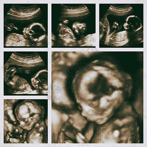 怀孕4个月3d胎儿超图片