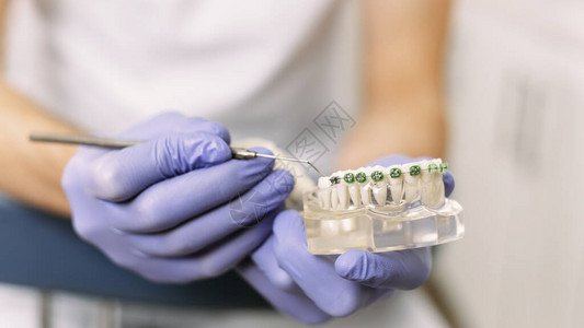 牙医展示了一个带牙套的人工颌骨模型如何正确护理口腔戴上牙套图片
