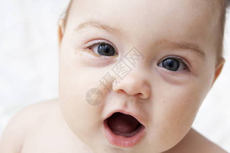一个眼睛发酸的婴儿患有结膜炎图片