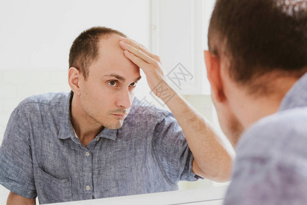 男型脱发问题概念年轻的白种人看着镜子担心秃顶男图片