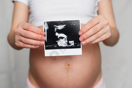 孕妇腹部背景下怀孕女孩手上的孕妇超声波照片图片