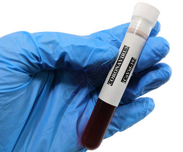 医生的手用血样在化学和细菌学分析实验室进行血清学检测以检测图片
