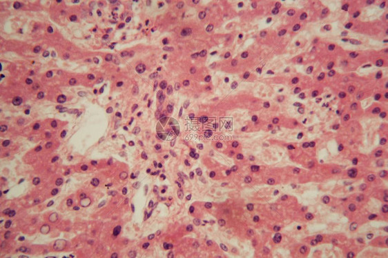 显微镜下的人类肝细胞有图片