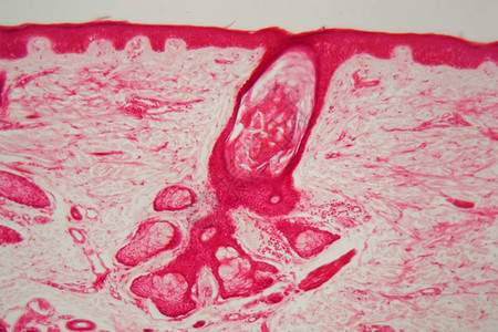 显微镜下的头发毛囊图片