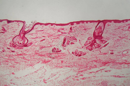 正常皮肤显微镜下图片图片