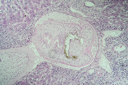 血吸虫病组织100x图片
