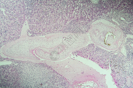 血吸虫病组织100x图片