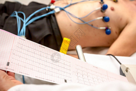 心脏病学家持有和审查在网格纸上打印的心电图EK图片