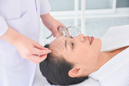 美丽的亚洲女在诊所接受面部针灸治疗图片