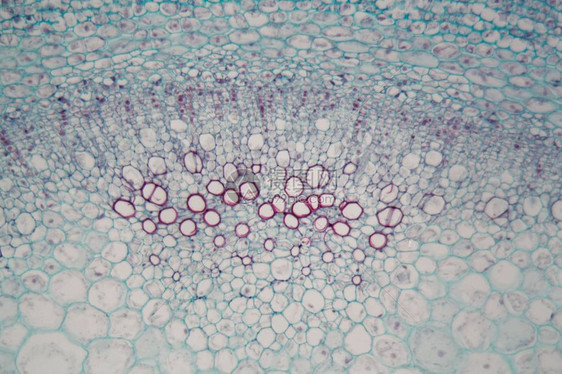 沙布库斯干部的显微镜照片图片
