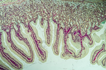 显微镜下大型肠胃背心组织在显微镜图片