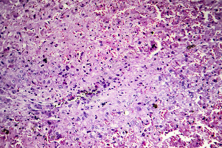 肝充血光学显微照片显微镜下的照片图片