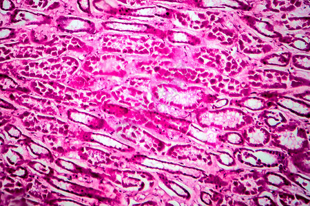 球状光显微成像仪显微镜下照片的弥散细胞背景
