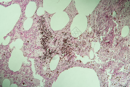肺组织作为显微镜下的粉尘图片