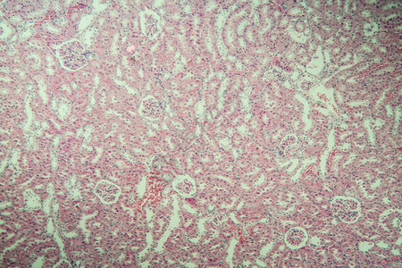 显微镜下的肾脏皮图片
