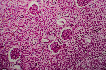 球状光显微成像仪显微镜下照片的弥散细胞图片