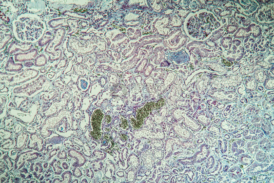 肾脏中的纤维素沉积显微镜检图片